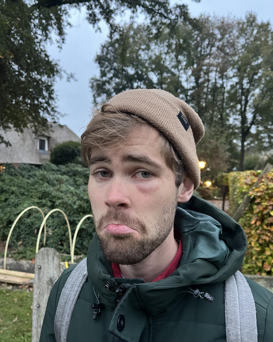 Thumbnail